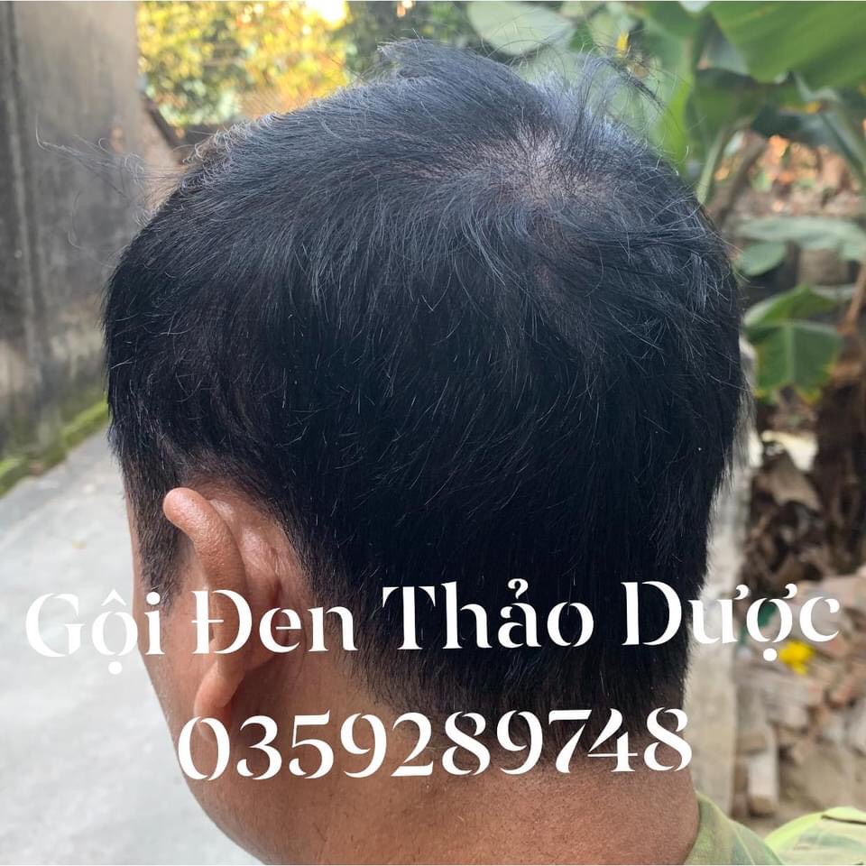 [KHÔNG DÍNH DA ĐẦU] Gội nhuộm đen tóc thảo dược (Nâu) tạo mái tóc đẹp và đều màu