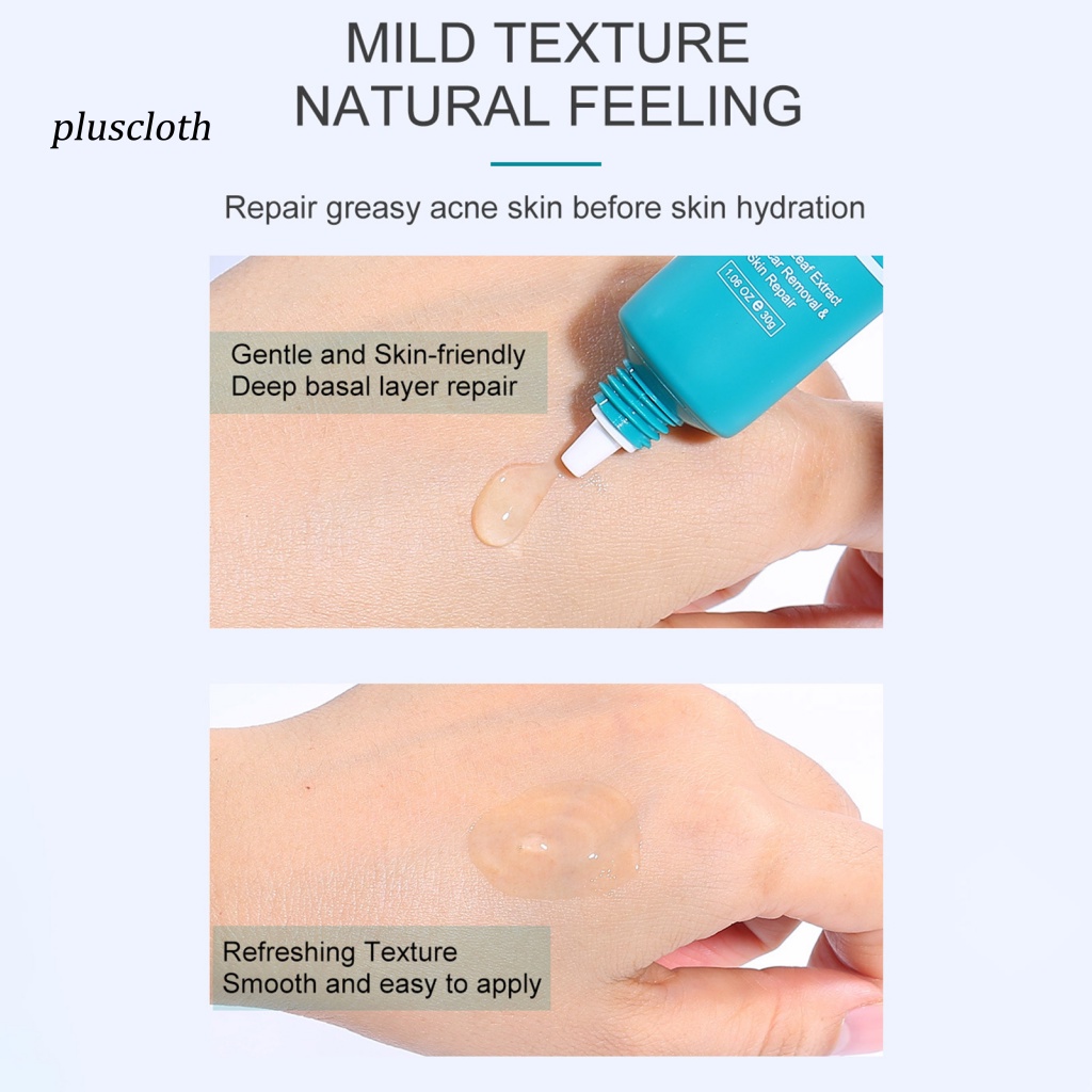 Tuýp Kem Hỗ trợ giảm mụn Trứng Cá Chăm Sóc Da Mặt 30g