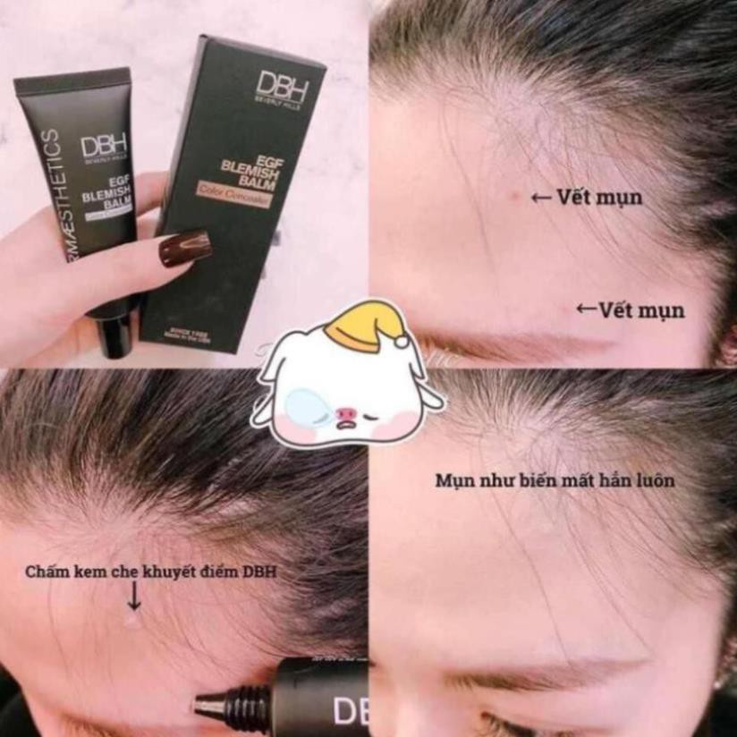 [CHÍNH HÃNG] Kem che khuyết điểm DBH EGF Blemish Balm Color Concealer 20ml | BigBuy360 - bigbuy360.vn