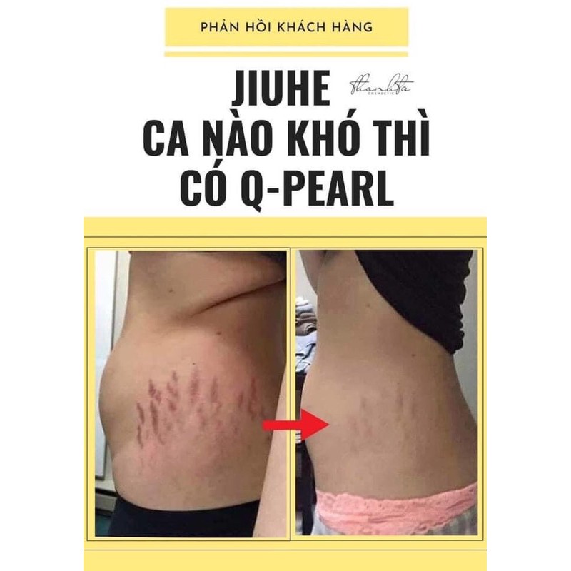 SERUM JIUHE THANH TÔ CHÍNH HÃNG 100% - JIUHE VUA GIẢM THÂM MẪU MỚI