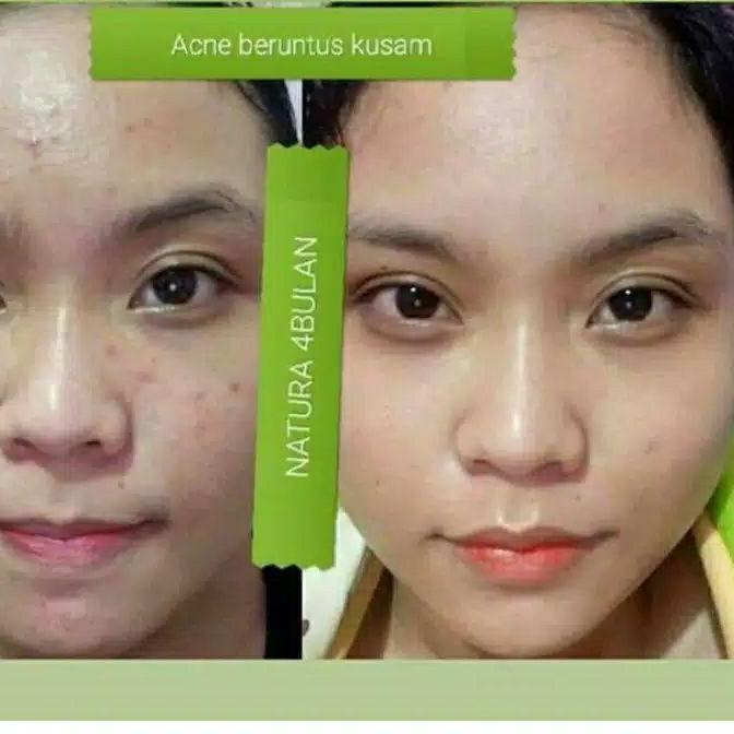 Cái thứ hai này! Tấm trải giường phun sương làm đẹp Lr075 Natura NBS Beuty Biuty Sprey Natura | BigBuy360 - bigbuy360.vn