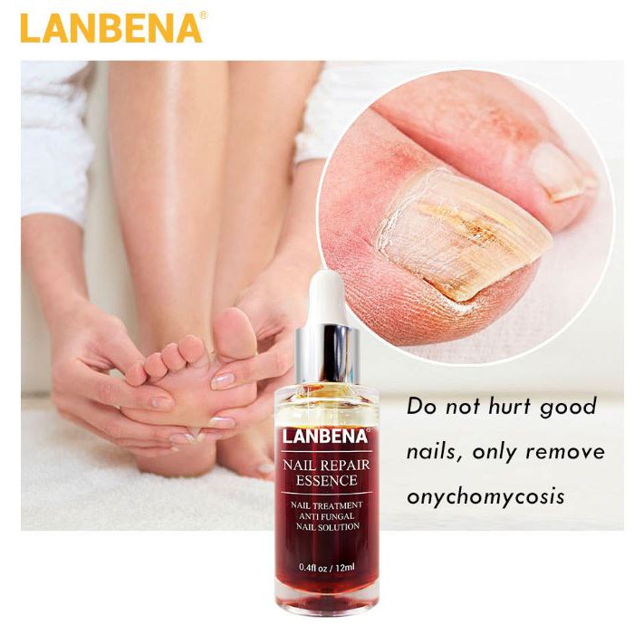 Serum Lanbena Phục Hồi Móng Tay Chân Chống Nấm - Nuôi Dưỡng Tái Tạo Móng