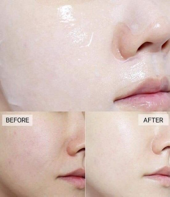Mặt nạ Mediheal Collagen Impact Essential Mask