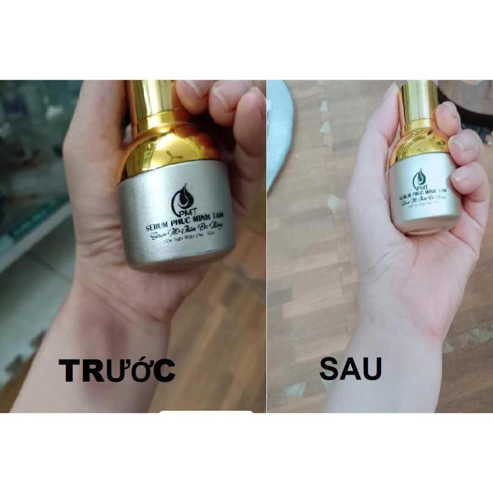 SERUM MỜ THÂM ĐA NĂNG PHÚC MINH TÂM [Hàng Chính Hãng Được Bảo Hộ]