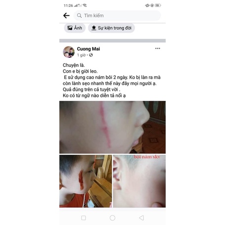 Cao nám thảo dược SKV