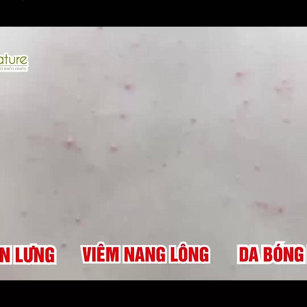 Muối Tắm Thảo Mộc I'm Nature - Muối Tắm Giảm Mụn Lưng, Mụn Body, Viêm Nang Lông 220Gr | BigBuy360 - bigbuy360.vn