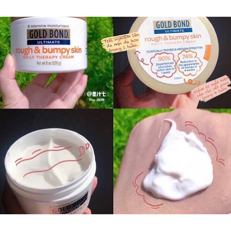 AUTH - OFF 40% LOTION KEM DƯỠNG DA MƯỚT MỊN TOÀN THÂN BODY GOLD BOND ULTIMATE ROUGE & BUMPY SKIN DAILY THERAPY CREAM