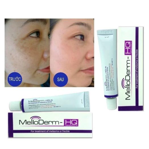 Kem Nám MelloDerm-HQ 4% Thái Lan Cho Da Nám, Tàn Nhang, Đồi Mồi