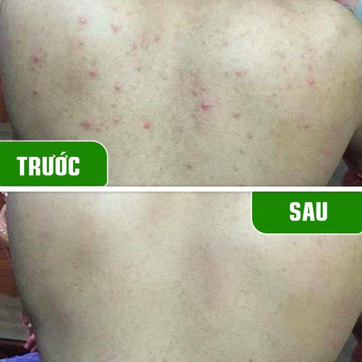 Xà phòng làm sạch mụn lưng Tiệm Mộc 130gr dạng bánh hương thơm hoa trái | BigBuy360 - bigbuy360.vn