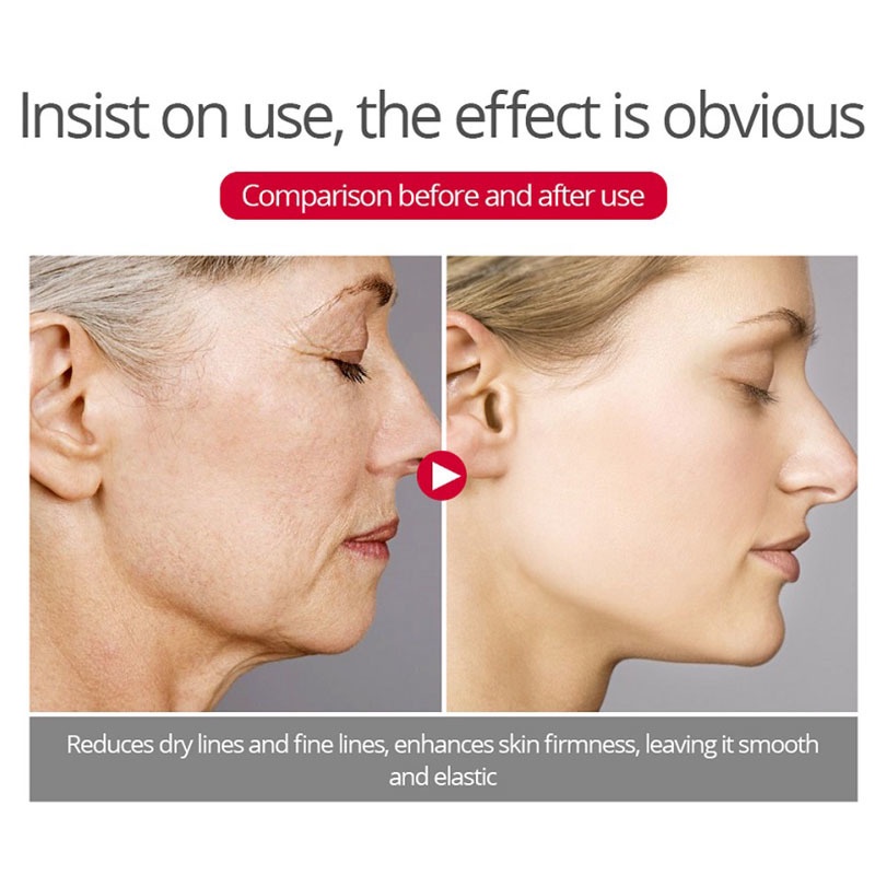 Kem Dưỡng Ẩm Retinol 20g Làm Săn Chắc Da Chống Lão Hóa Xóa Nếp Nhăn