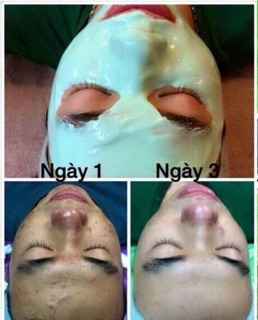 Mask Dẻo Bạc Hà Chuyên Dùng cho SPA