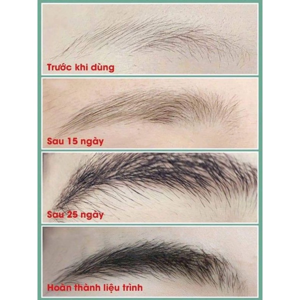 𝐒𝐞𝐫𝐮𝐦 𝐤𝐢́𝐜𝐡 𝐦𝐨̣𝐜 𝐥𝐨̂𝐧𝐠 𝐦𝐚̀𝐲,𝐝𝐮̛𝐨̛̃𝐧𝐠 𝐦𝐚̀𝐲 𝐝𝐚̀𝐲 𝐤𝐡𝐨̉𝐞 | BigBuy360 - bigbuy360.vn