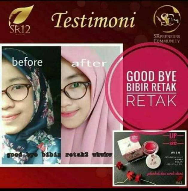(hàng Mới Về) Gel Chăm Sóc Môi Làm Sáng Sr12 | BigBuy360 - bigbuy360.vn