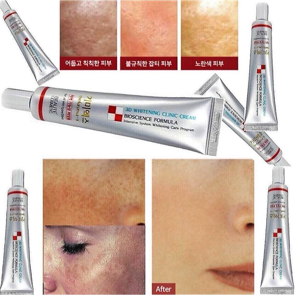 Kem Ngừa Nám Và Tàn Nhang Melasma-X 3D Whitening Clinic Cream