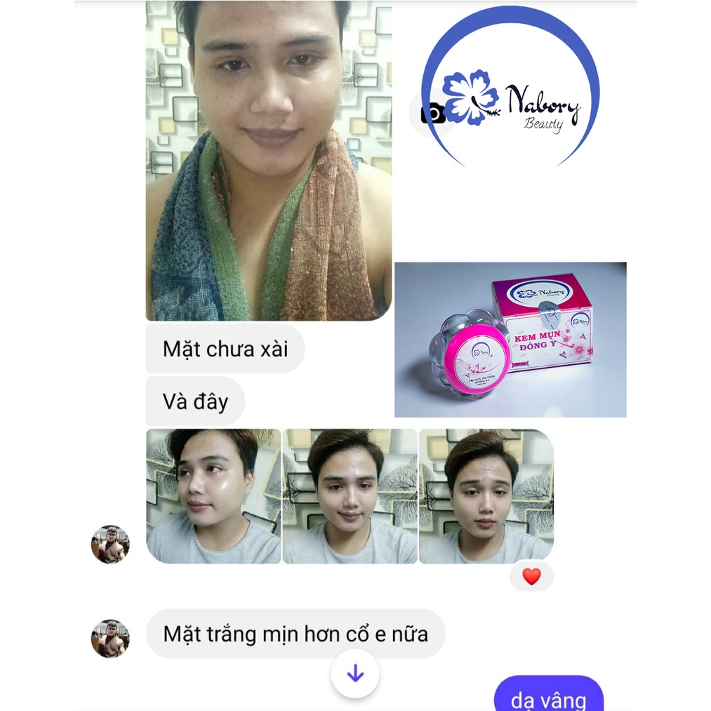 Combo 2 hộp kem mụn đông y Nabory Beauty [Quà bột đắp mặt] | BigBuy360 - bigbuy360.vn