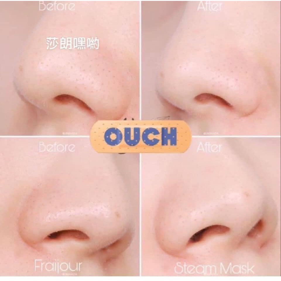 Mặt Nạ Đất Sét Ngải Cứu Nóng Fraijour Artemisia Steam Mask