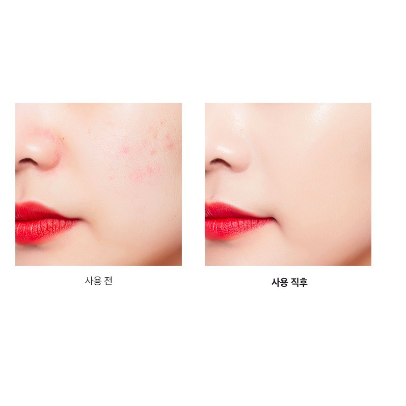 MBC Phấn nước dành cho da mụn COSRX Blemish Cover Cushion | BigBuy360 - bigbuy360.vn