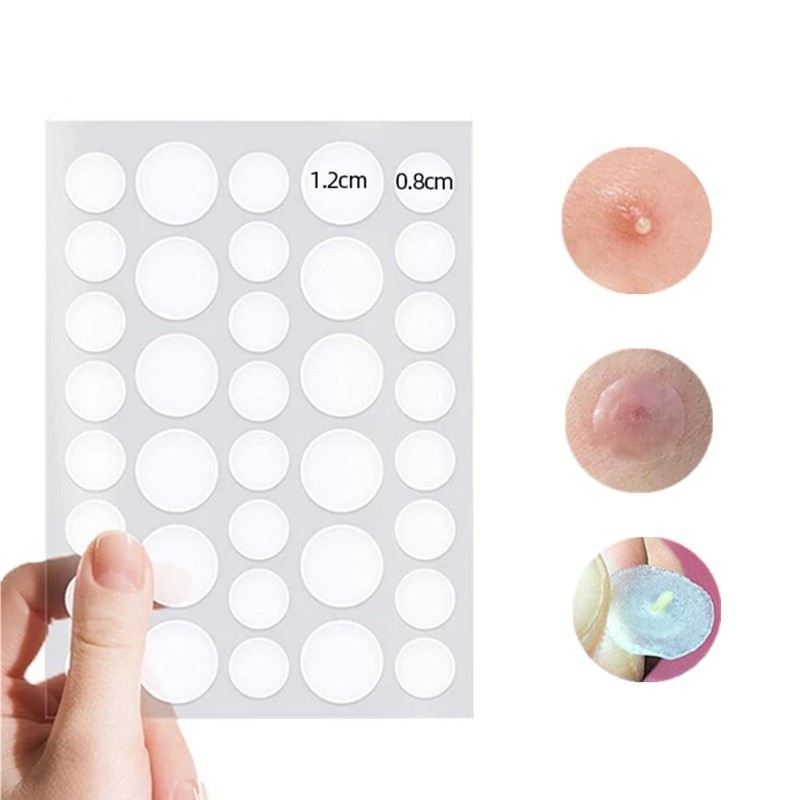 Combo 36 miếng dán mụn, hiệu quả xẹp mụn nhanh | BigBuy360 - bigbuy360.vn