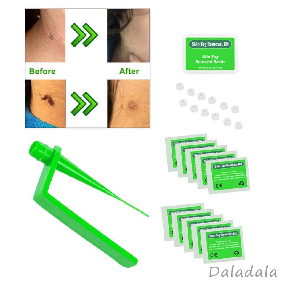 Micro Skin Tag Removal Device Kit for Small to Medium Skin Tags for Men Women, Green