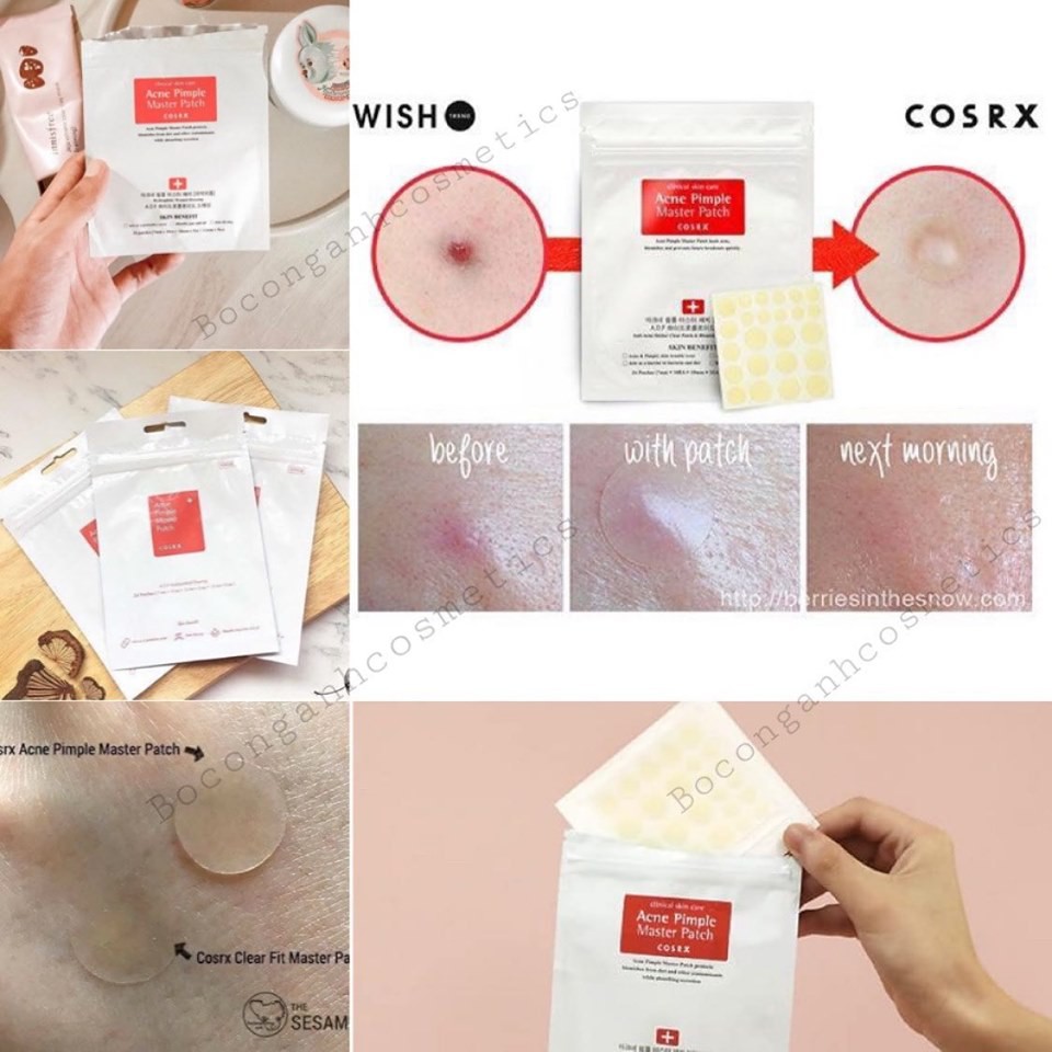 MIẾNG DÁN MỤN COSRX ACNE PIMPLE MASTER PATCH (SẴN)