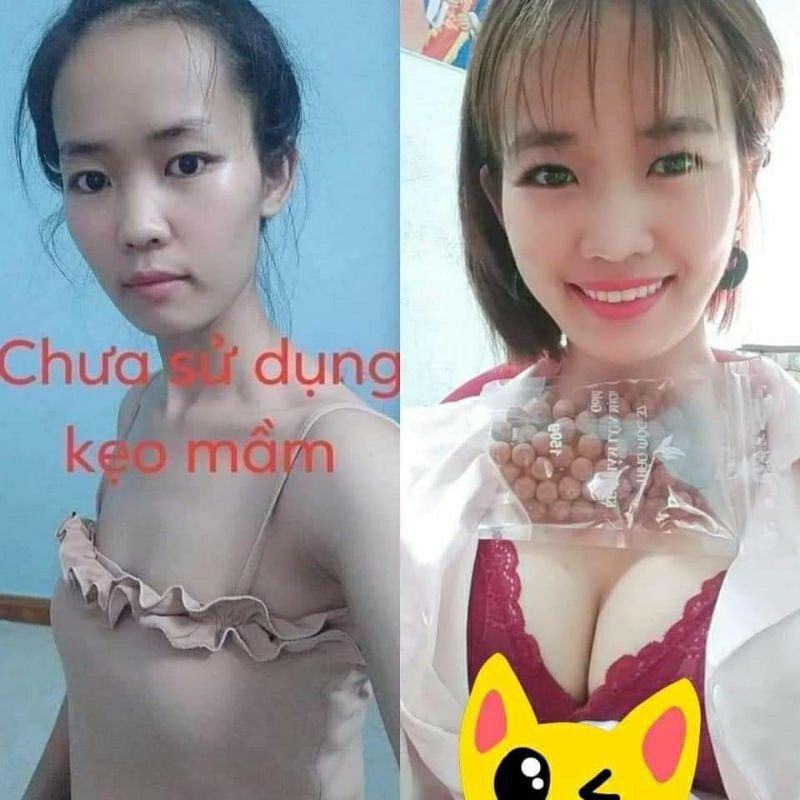 [Chính Hãng +Date mới] 5 Hộp Kẹo Mầm Lúa Mạch Gold Thảo Mộc 37 | BigBuy360 - bigbuy360.vn