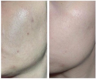 Mặt nạ bịch Melano Cc nội địa Nhật