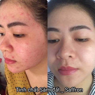 Tinh Chất Sâm Đất Saffron Dr Cell 20ml giảm mụn ngăn ngừa mụn trắng da