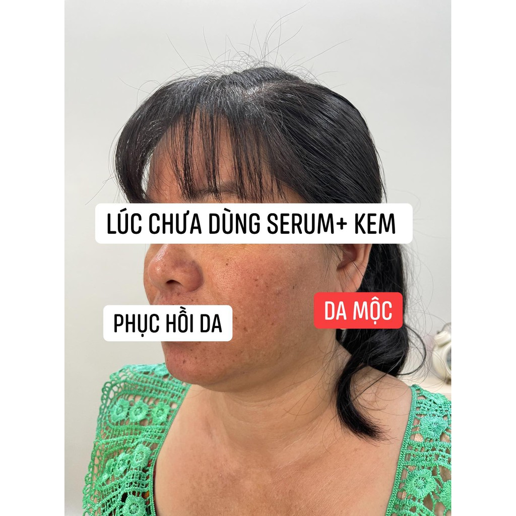 SHOP HIỀN - KEM TRỊ MỤN | BigBuy360 - bigbuy360.vn