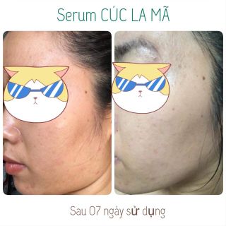 Serum cúc la mã