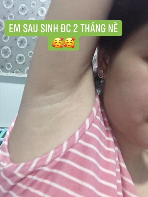 KEM TRỊ THÂM HÔI NÁCH CÔ BƠ SHOP