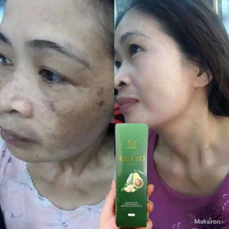 [CHÍNH HÃNG] KEM BƠ OLIC CẤY TRẮNG NUÔI DA MẪU MỚI | BigBuy360 - bigbuy360.vn