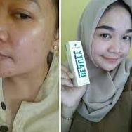 ! Chai Xịt Làm Đẹp Code-770 Natura Nguyên Bản 100% | BigBuy360 - bigbuy360.vn