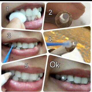 Combo 200v, 20 hộp đựng đá, 20keo, bút gắn