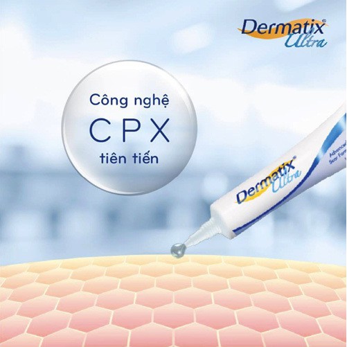 GEL SẸO DERMATIX ULTRA (7G)