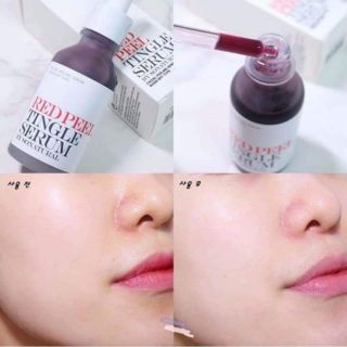 RED PEEL TINGLE SERUM