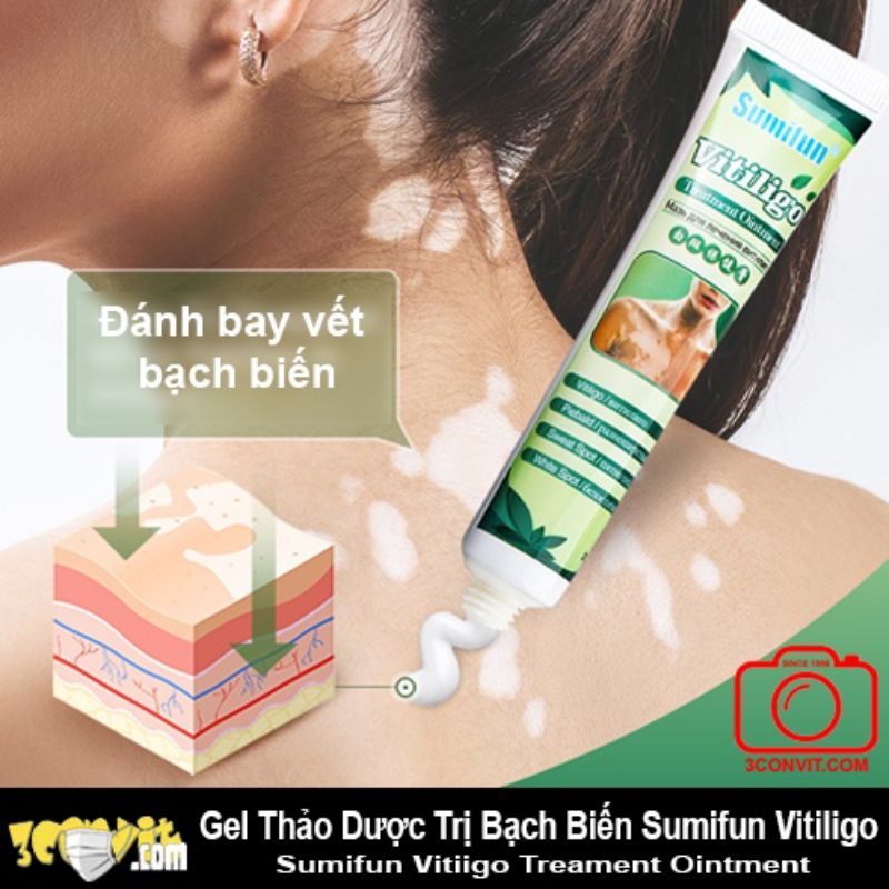 Thảo dược bôi bạch biến Sumifun