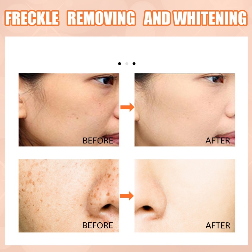 Kem Vitamin C Xóa Đốm Nâu 15ml Giúp Dưỡng Ẩm Và Làm Trắng Da Cao Cấp