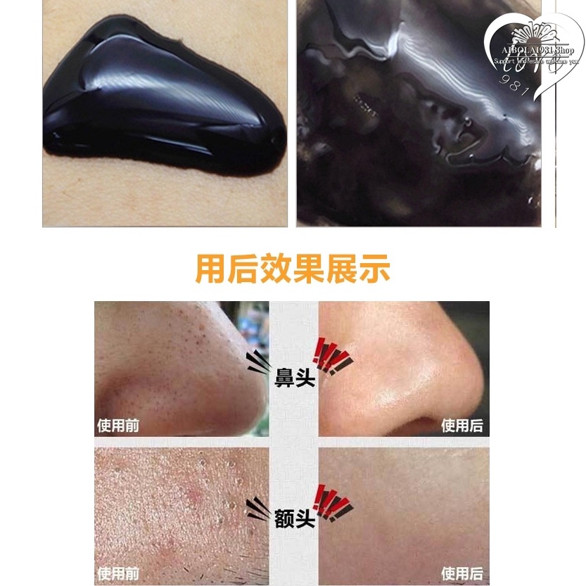 Mặt nạ mũi lột mụn đầu đen làm sạch da | BigBuy360 - bigbuy360.vn