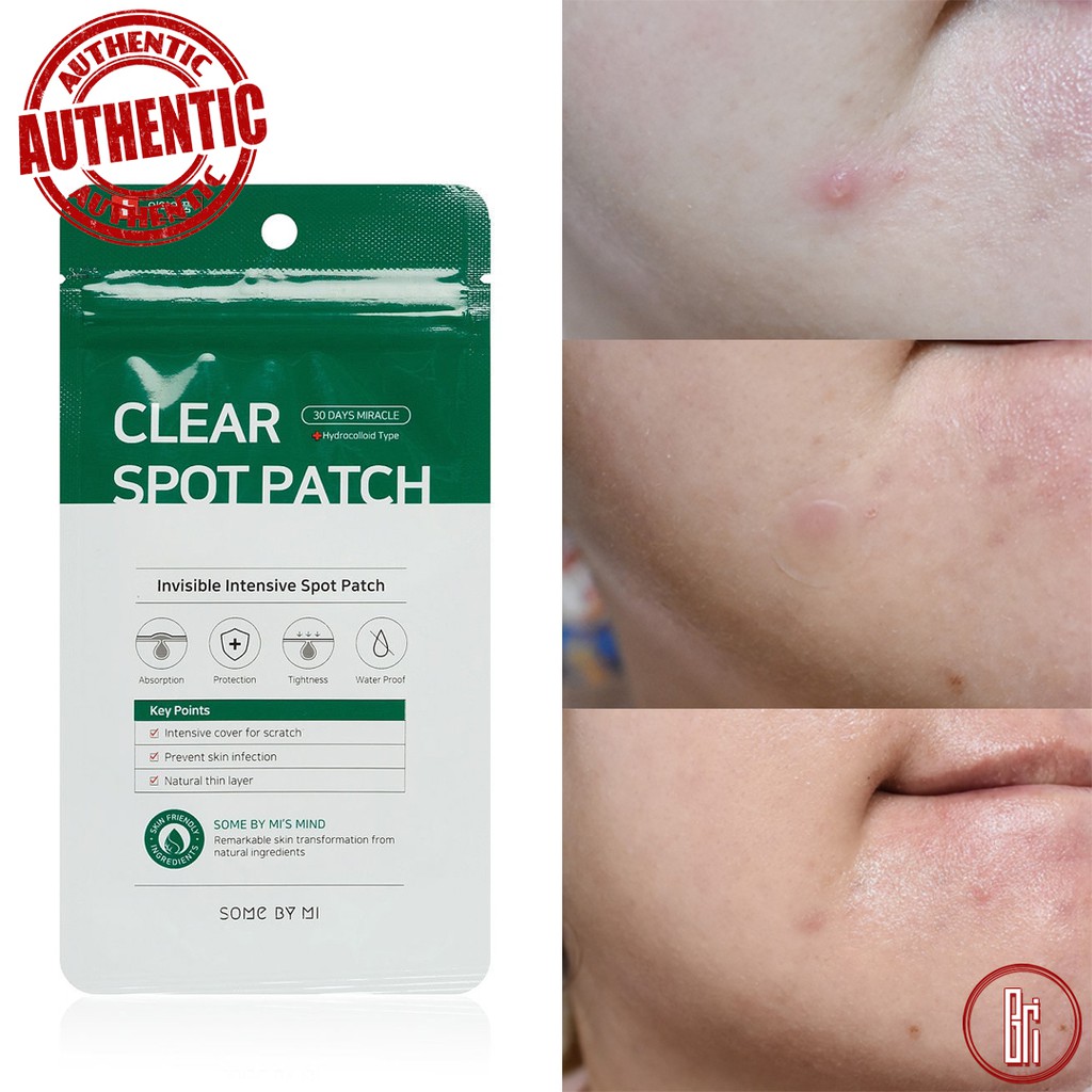 Miếng Dán Mụn Some By Mi Clear Spot Patch