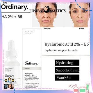 (Chính Hãng) Serum The Ordinary Hyaluronic Acid 2% + B5 siêu dưỡng ẩm 30ml