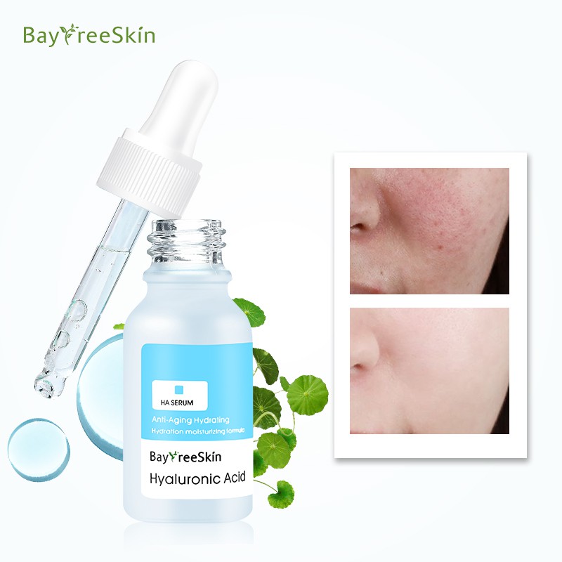 Tinh chất dưỡng ẩm làm trắng da Bayfree Hyaluronic Acid 17ml