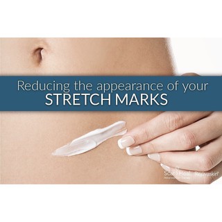 Kem Sẹo Scar Esthetique USA