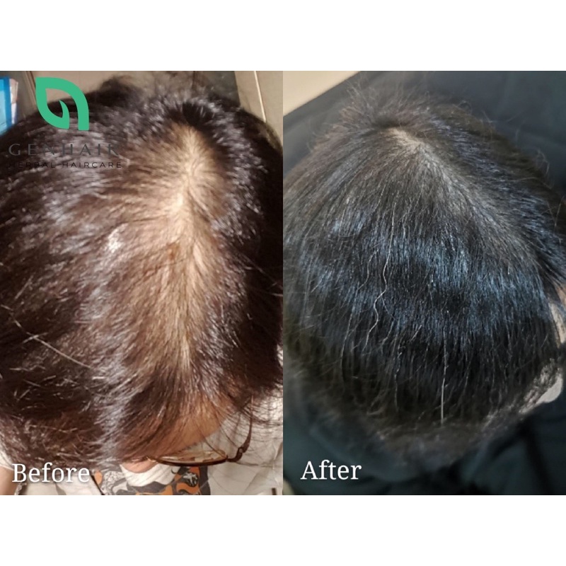 Chiết xuất hà thủ ô - Fo-ti extract - Mọc tóc nhanh chóng, ngăn ngừa lão hoá chân tóc