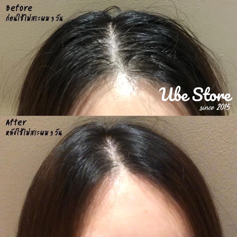 TẨY DA CHẾT DA ĐẦU YVES ROCHER SCRUB 150ML