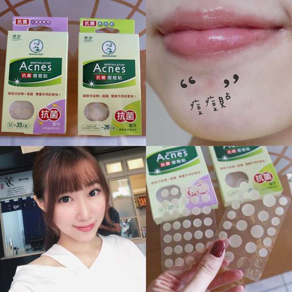 Míếng dán mụn Mentholatum Acnes từ Đài Loan