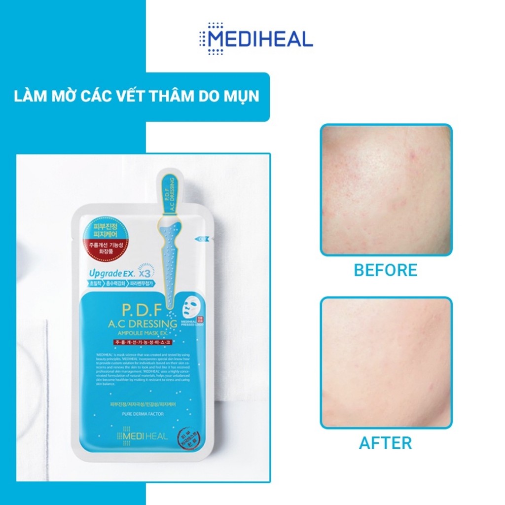 Mặt Nạ Mediheal P.D.F Giảm Mụn Làm Dịu Da AC - Dressing Ampoule Mask Ex 25ml