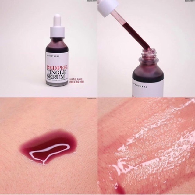 [Mẫu Mới 35ml/20ml] Thần Duợc Tẩy Da Chết Hóa Học Red Peel Tingle Serum | BigBuy360 - bigbuy360.vn