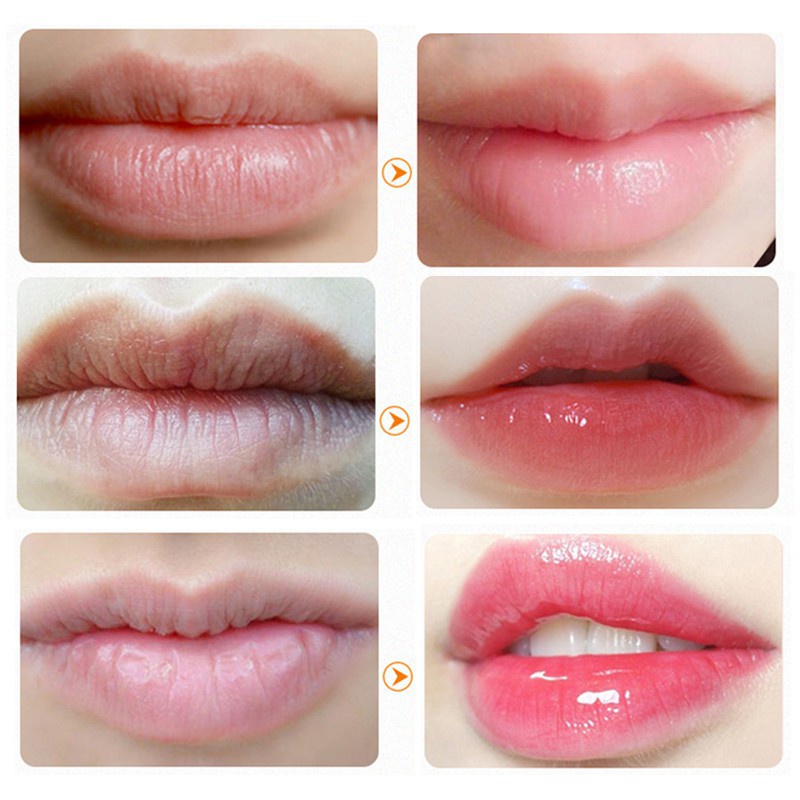 [Hàng mới về] Mặt Nạ Môi Collagen Dưỡng Ẩm Chống Nếp Nhăn