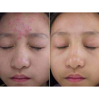 Sữa rửa mặt Immuno - Nga