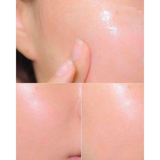 KEM DƯỠNG ẨM NEUTROGENA